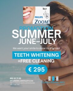 Teeth whitening in Marbella