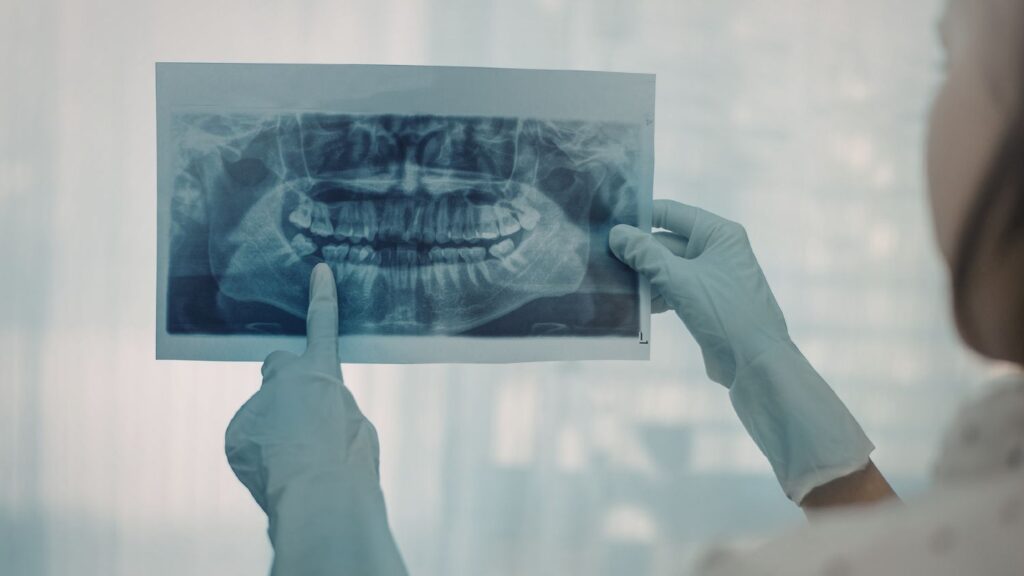 need a root canal